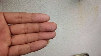 渋川市赤城外壁チョーキング現象